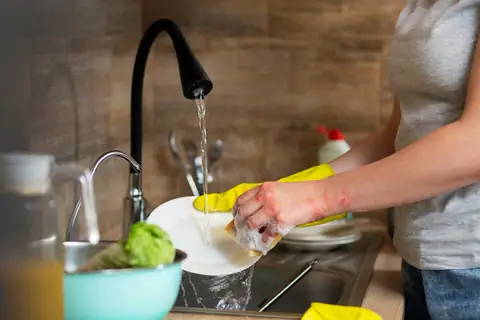 Springfield Restaurant Caught Washing Dishes With a Garden Hose
